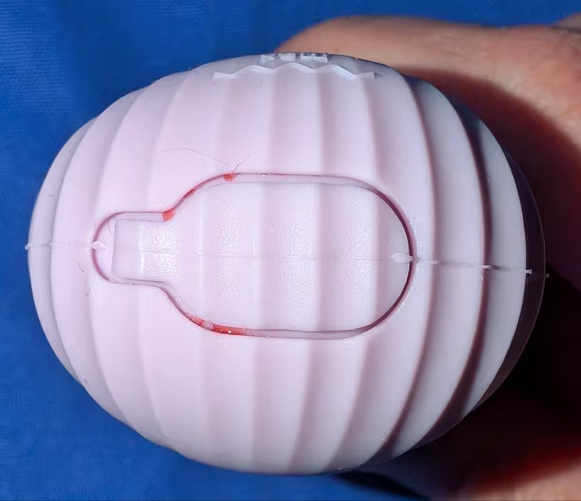 Ice Globe Face Roller | Cryo Facial Massager & Depuffing Tool